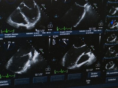 ultrasound-509396_1280